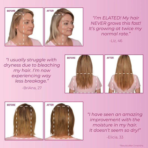 MendXtend Strengthening System Starter Pack