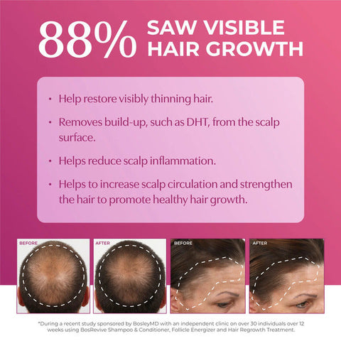 Women Hair Regrowth Treatment 2% Dropper